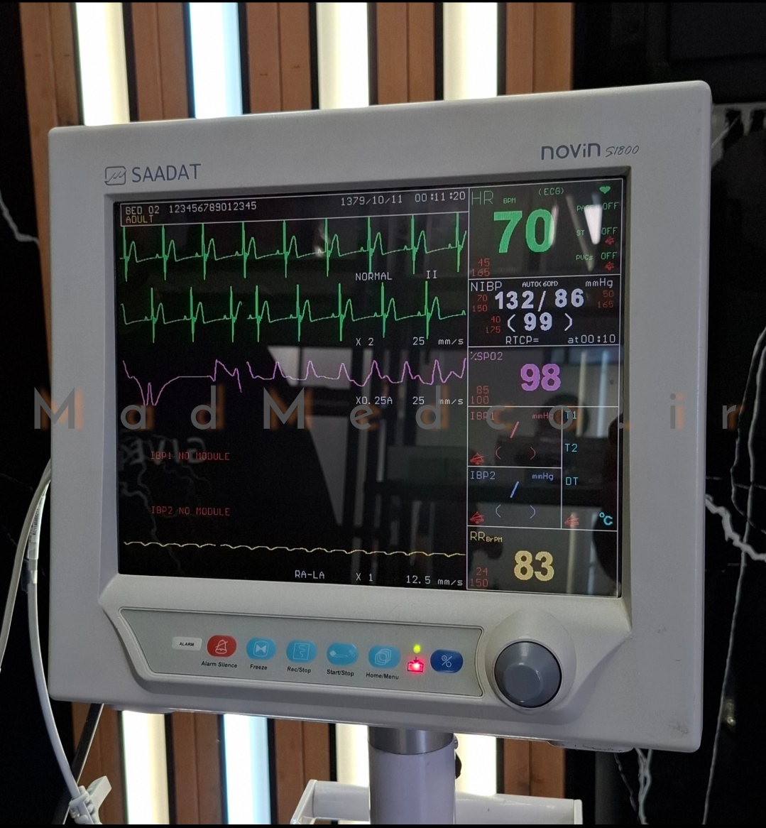 مانیتور علائم حیاتی پویندگان راه سعادت مدلsaadat novin s1800