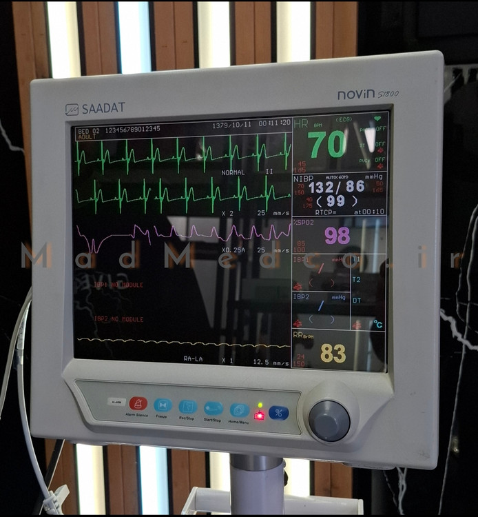 مانیتور علائم حیاتی پویندگان راه سعادت مدلsaadat novin s1800
